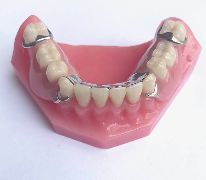 Best Partial Dentures to Restore Your Smile Shelby Dental Center