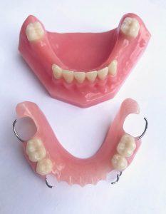 Flexible Partial Dentures