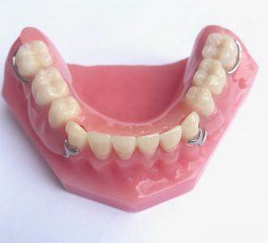 Flexible Partial Bottom Dentures