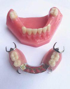 Flexible Partial Dentures