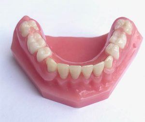 Flexible Partial Bottom Dentures