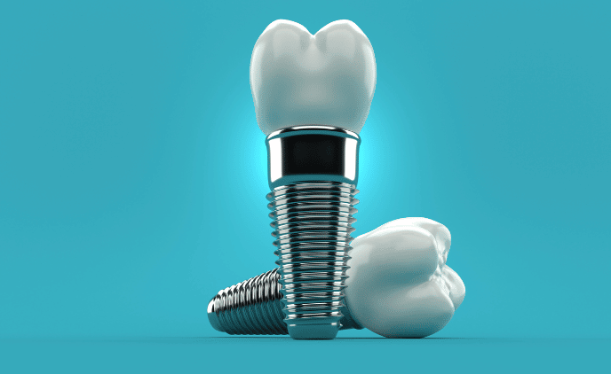 Dental Implants: Types, Benefits, and More
