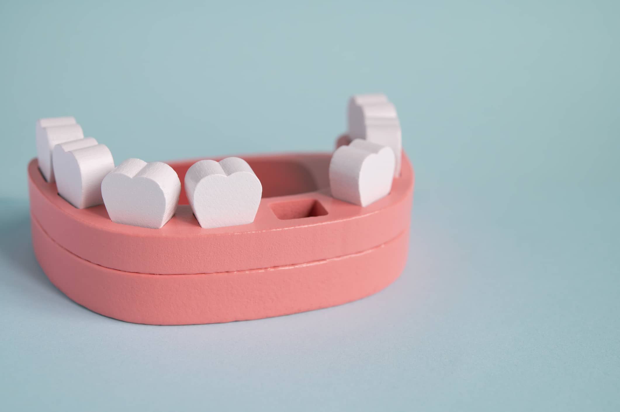 A wooden model of teeth and gums with one missing, representing tooth loss in adults.