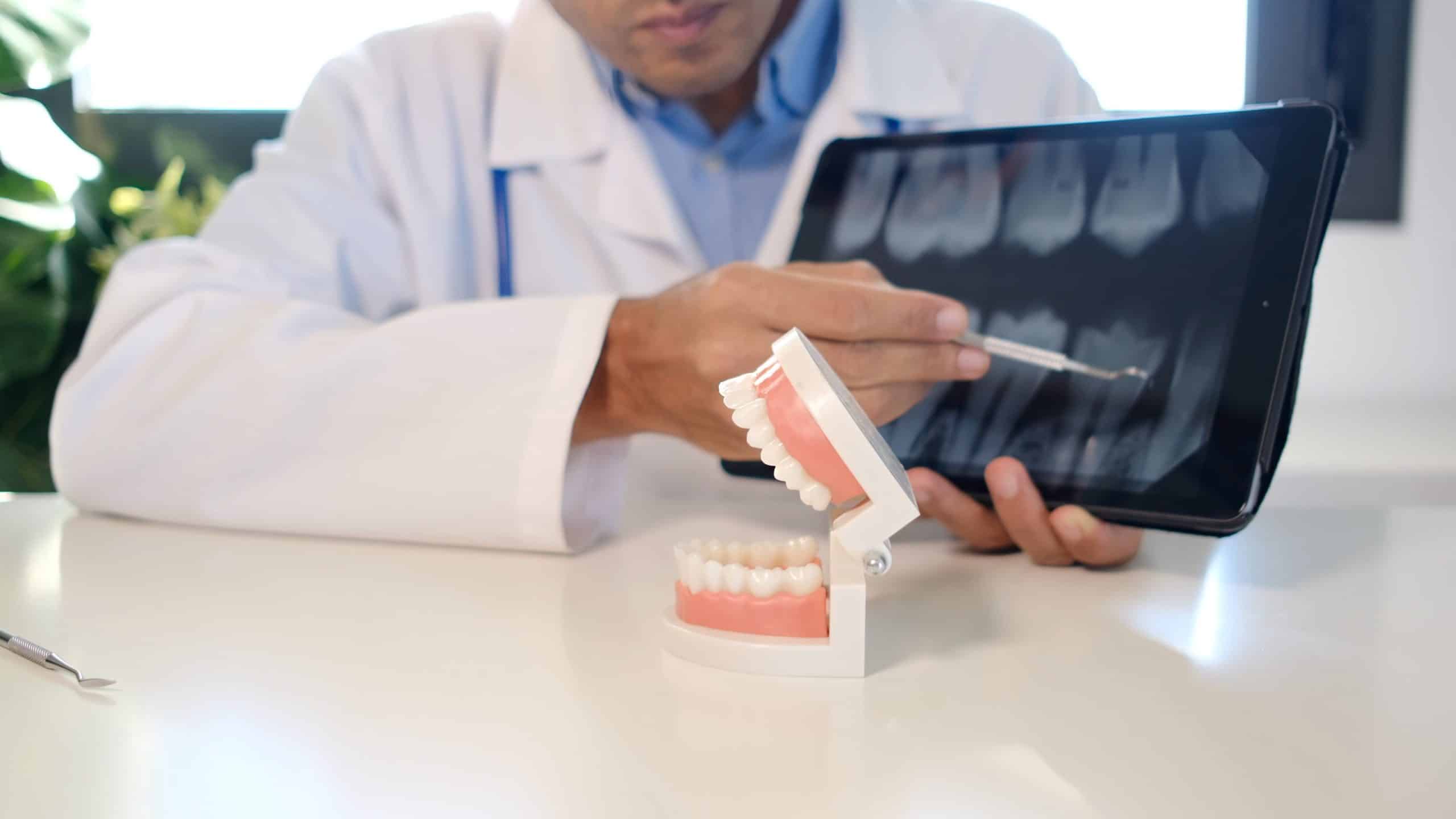 Dentist at Shelby Dental Center in Calera showing a patient an X-ray to decide between a filling and a crown.